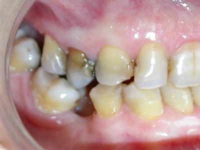 Cas 3 - Vue vestibulaire initiale